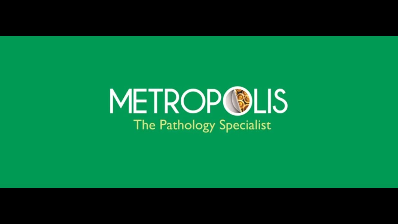 metropolis